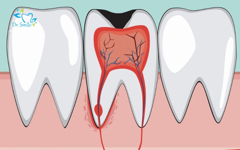 Dental pulp