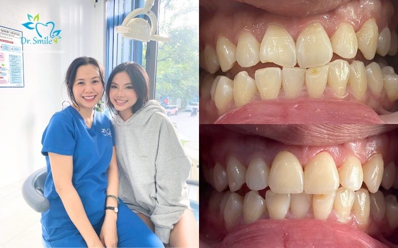A "star-standard" smile that is both sophisticated and healthy