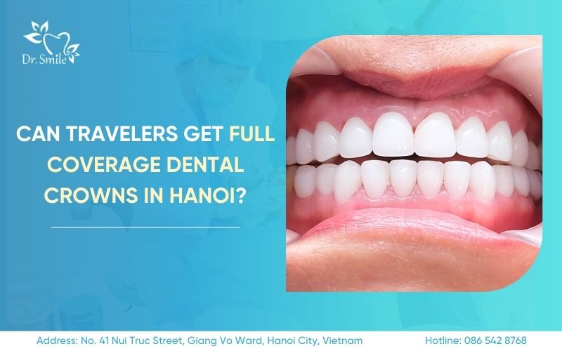 full coverage dental crowns in Hanoi
