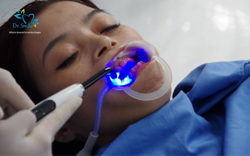 Teeth whitening at the clinic