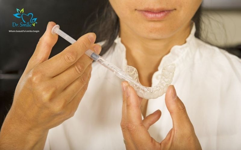 At-home teeth whitening