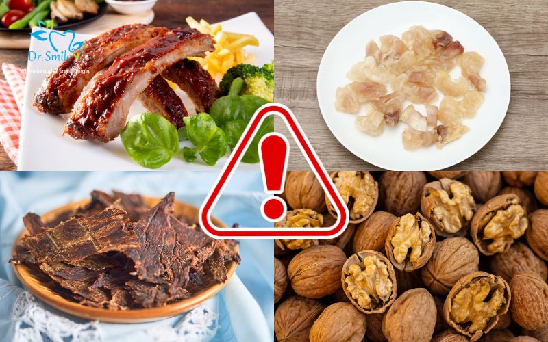 Avoid biting on overly hard foods