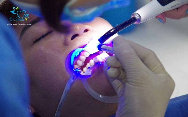 Emergency dental services available at Dr.Smile