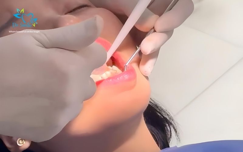 Dental emergency Hanoi