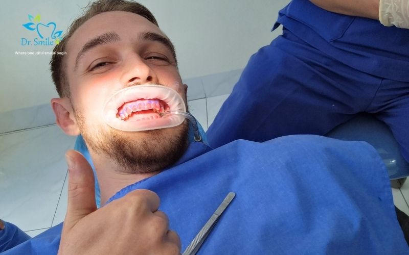 Best teeth whitening service