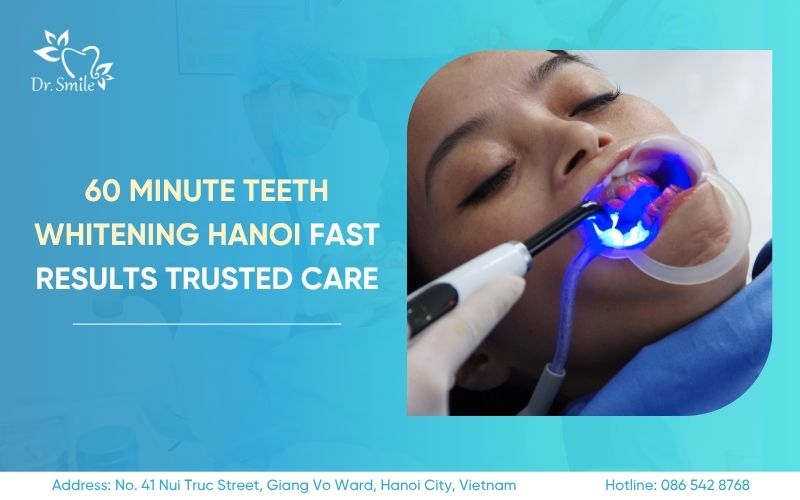 60 minute teeth whitening Hanoi