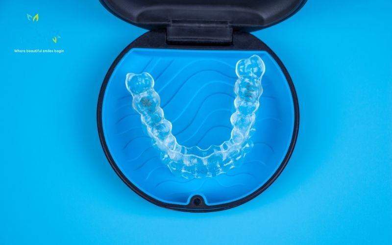 Invisalign hanoi cost for foreigners