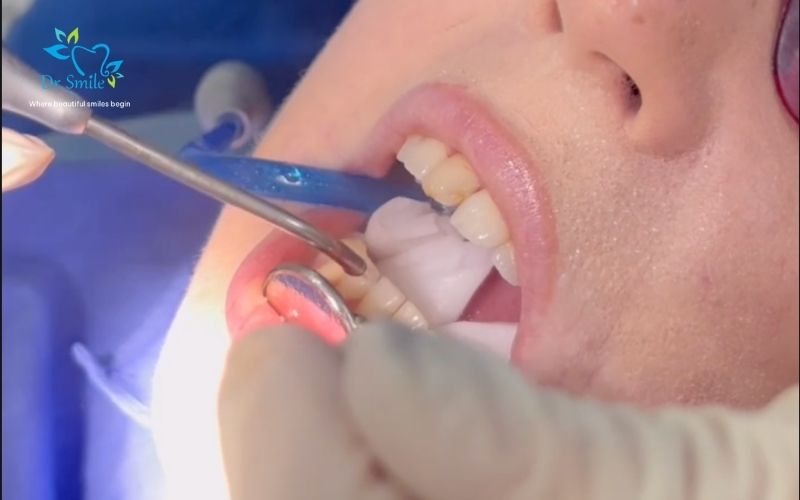 A clean, healthy smile helps you feel more comfortable