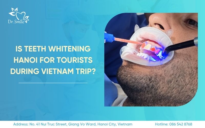 teeth whitening hanoi for tourists