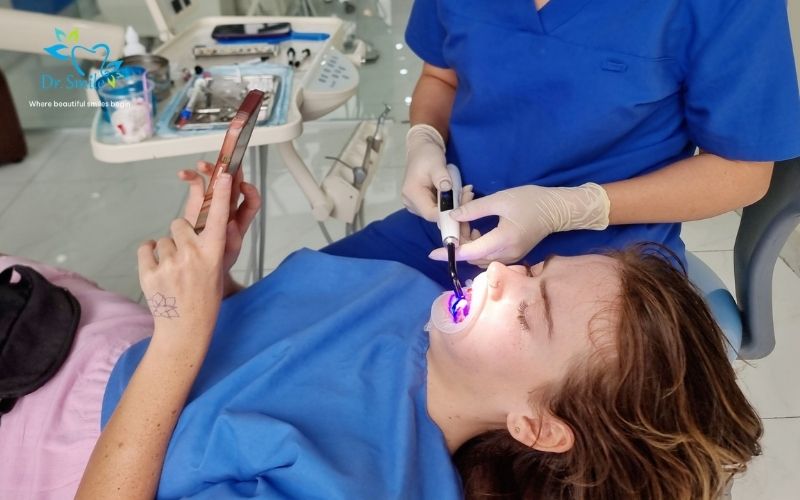 Whitening Combined with Dental Cleaning