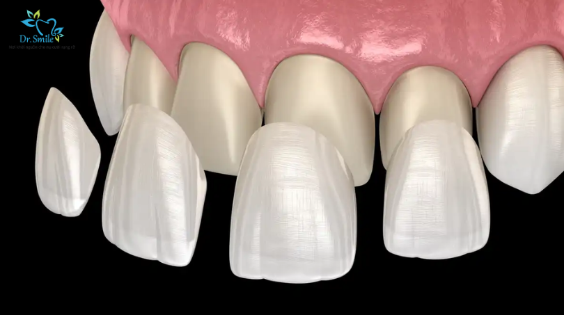 cheap porcelain crowns near me