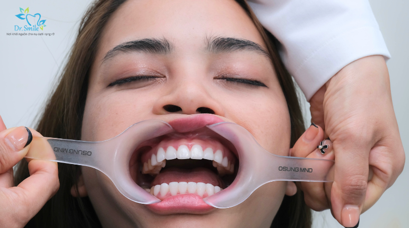 Professional evaluation for customized dental crown treatment.