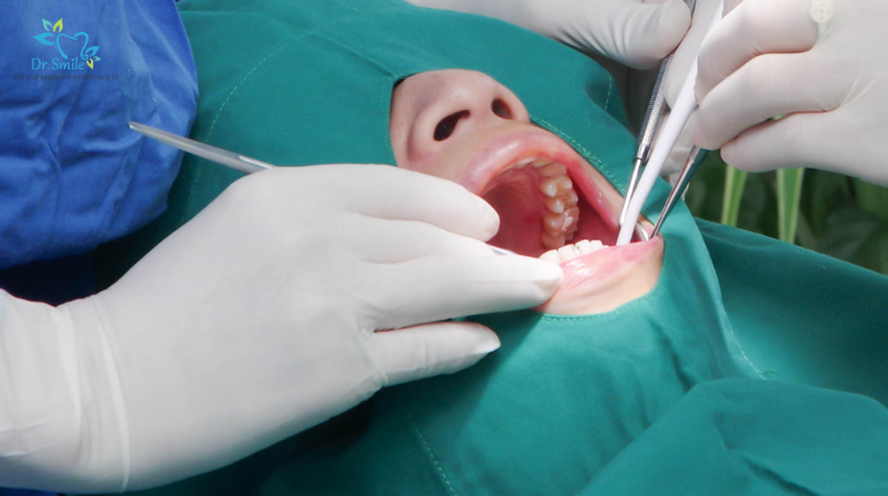 Understanding the main factors behind implant costs