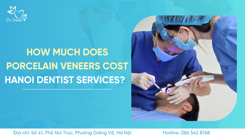 Porcelain veneers cost Hanoi dentist