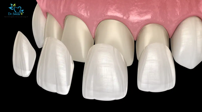 Examining the natural teeth
