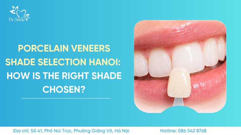 Porcelain veneers shade selection Hanoi: How is the right shade chosen?